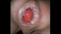 My Gaped Pussy, Amature Model/Actor: Jim Robins Thumb