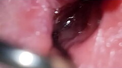 penis spreading Thumb